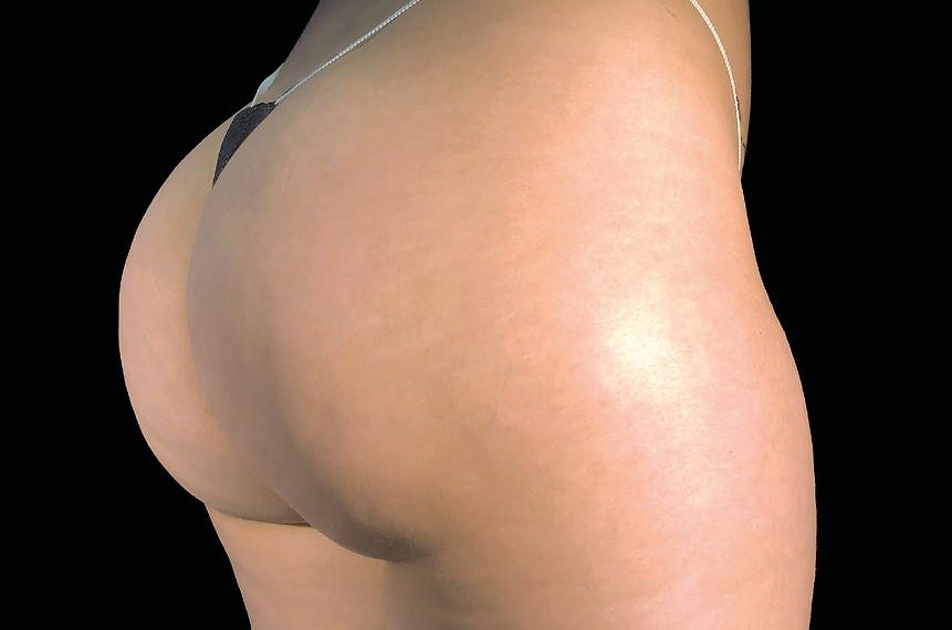 Body Sculpting Example